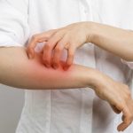 allergie au poivre 1