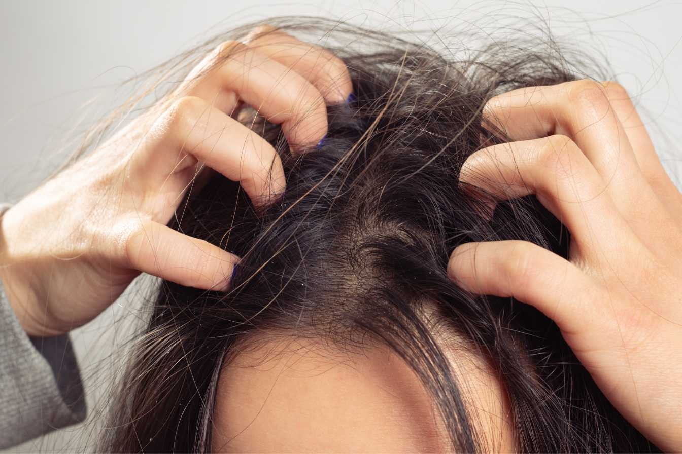 cuir chevelu qui gratte signification spirituelle 1